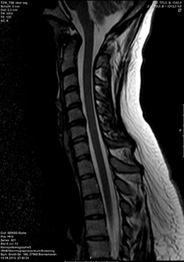 mrt-hws-magnetresonanztomographie