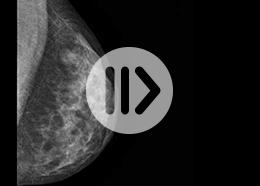 filmfenster-mammographie