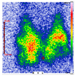 schilddruesendiagnostik-sonographie