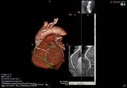cardio-ct-radiologie