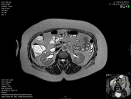 mr-ct-sellink-radiologie