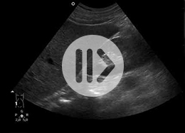 filmfenster-sonografie